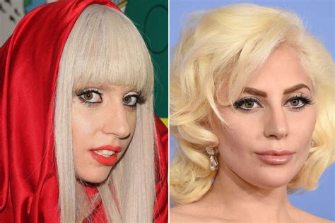 lady gaga surgery|The Truth About Lady Gagas Plastic Surgery Rumors。